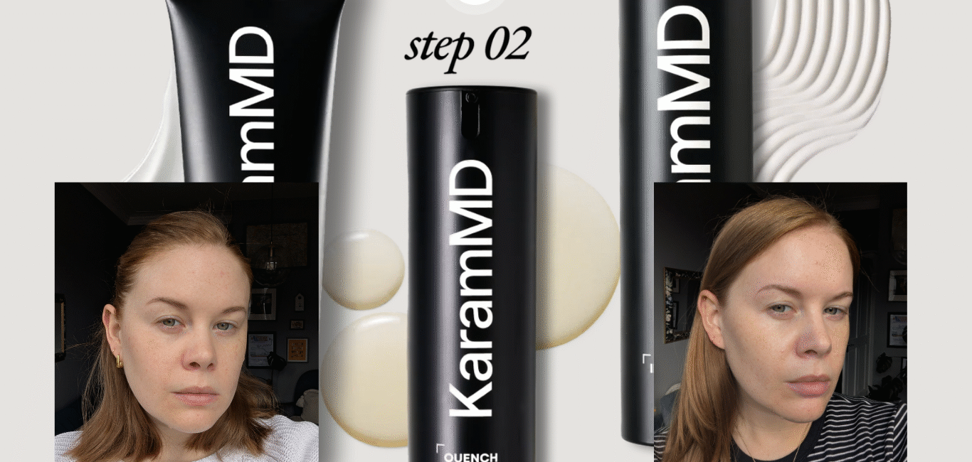 The KaramMD Trifecta products with Alice Hinds pictured before and after either side