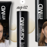 The KaramMD Trifecta products with Alice Hinds pictured before and after either side