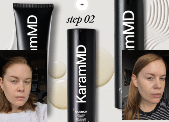 The KaramMD Trifecta products with Alice Hinds pictured before and after either side