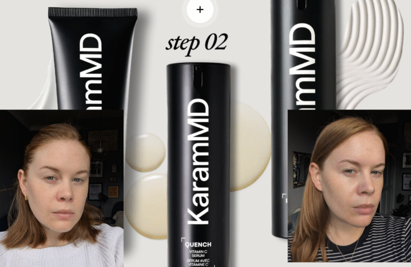 The KaramMD Trifecta products with Alice Hinds pictured before and after either side